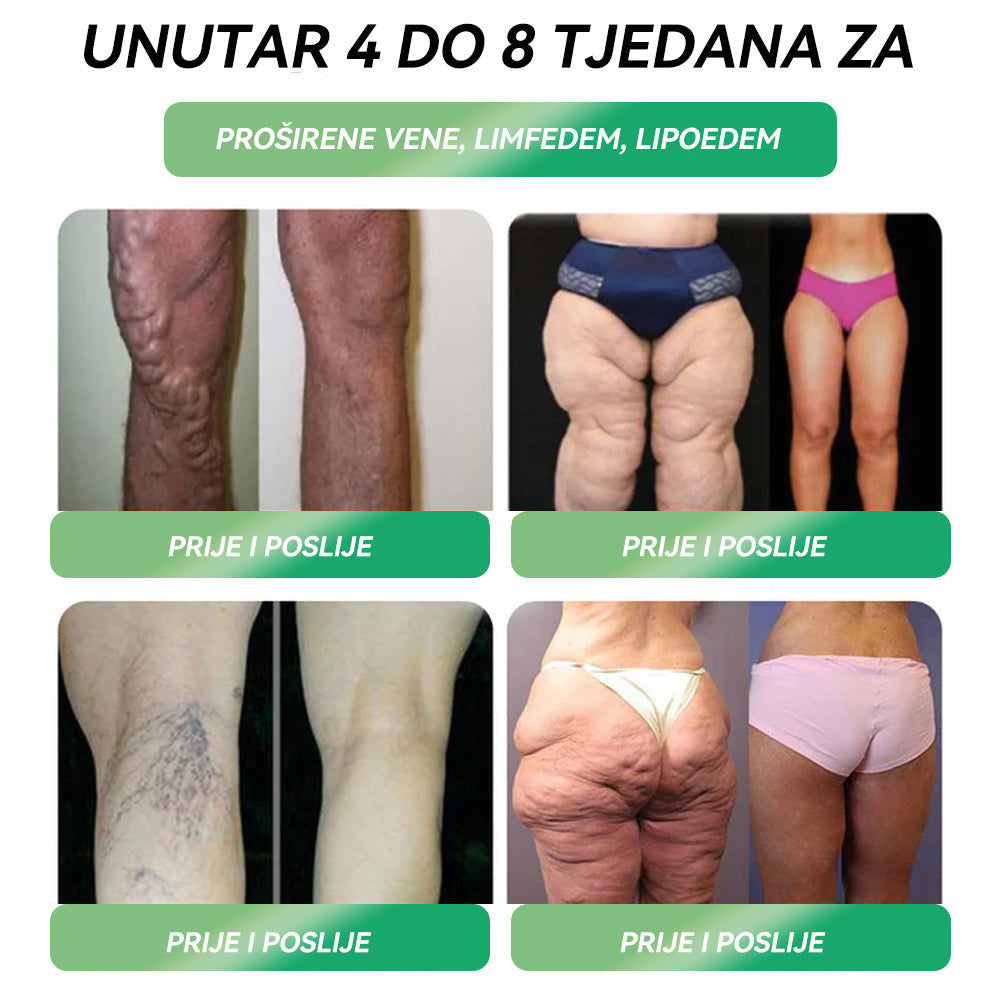 ✅ Preporučuje više od 100 000 ljudi | službena trgovina | 𝐒𝐓𝐃𝐄𝐈® 👨👧👧👨👧👧 𝐆𝐋𝐏-𝟏 𝐌𝐫š𝐚𝐯𝐥𝐣𝐞𝐧𝐣𝐞 𝐎𝐫𝐚𝐥𝐧𝐚 𝐨𝐭𝐨𝐩𝐢𝐧𝐚 - Pretilost, kardiovaskularne bolesti, dijabetes, apneja u snu, problemi sa zglobovima i još mnogo toga