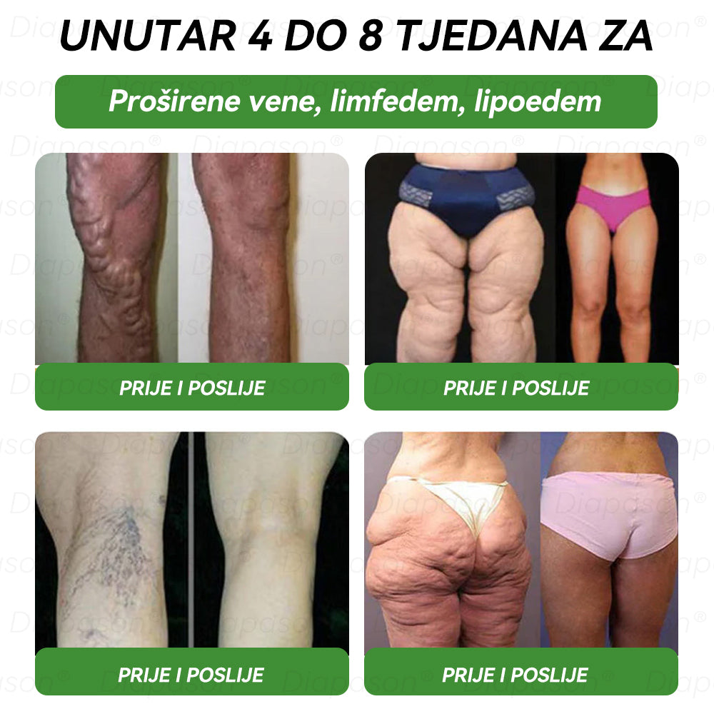 𝑆𝑙𝑢ž𝑏𝑒𝑛𝑎 𝑇𝑟𝑔𝑜𝑣𝑖𝑛𝑎 | 𝐃𝒊𝓪𝐩𝓪𝙨𝐨𝒏®👨‍⚕️👨‍⚕️𝐺𝐿𝑃-1 𝑆𝑒𝑑𝑎𝑚 𝑢 𝐽𝑒𝑑𝑛𝑜𝑚 𝑂𝑟𝑎𝑙𝑛𝑎 𝑇𝑒𝑘𝑢ć𝑖𝑛𝑎 𝑍𝑎 𝑍𝑑𝑟𝑎𝑣𝑙𝑗𝑒 - Pretilost, kardiovaskularne bolesti, dijabetes, apneja u snu, problemi sa zglobovima i još mnogo toga